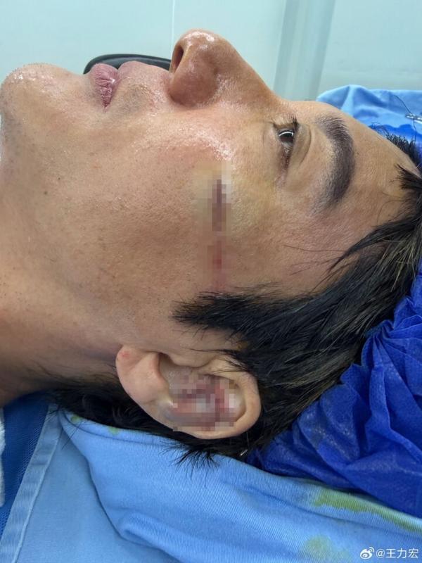 Vương Lực Hoành ảnh 2 Vương Lực Hoành ảnh 2