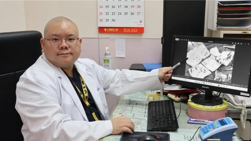 Sùi mào gà ảnh 1 Sùi mào gà ảnh 1