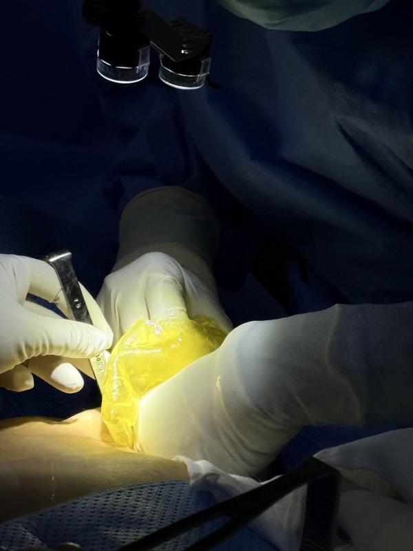 túi ngực ảnh 1 túi ngực ảnh 1