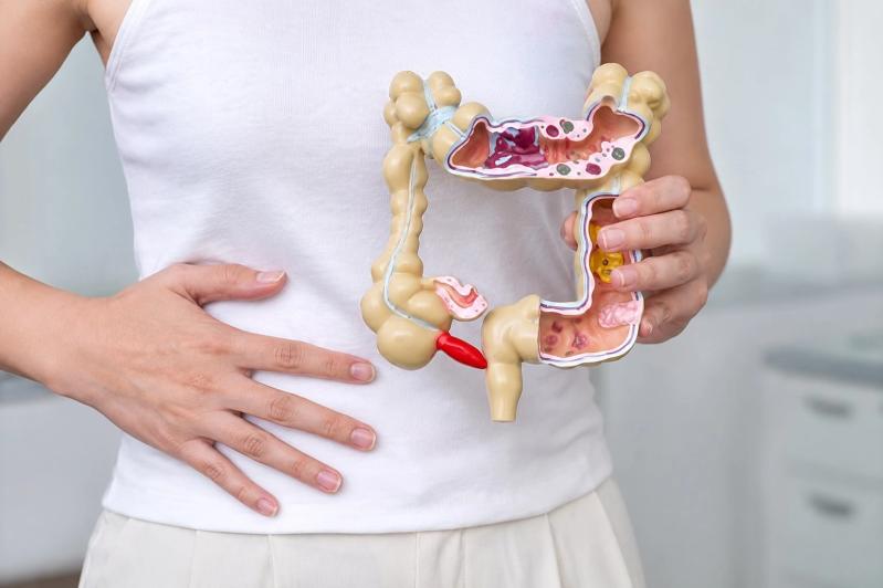 Đường ruột khỏe mạnh ảnh 1 Đường ruột khỏe mạnh ảnh 1