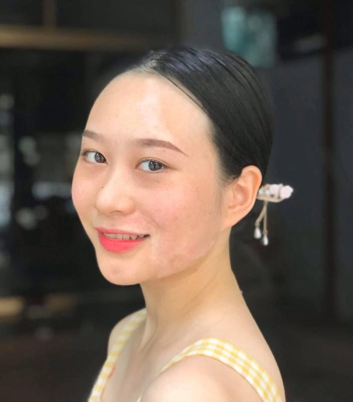 bệnh bạch biết ảnh 6 bệnh bạch biết ảnh 6